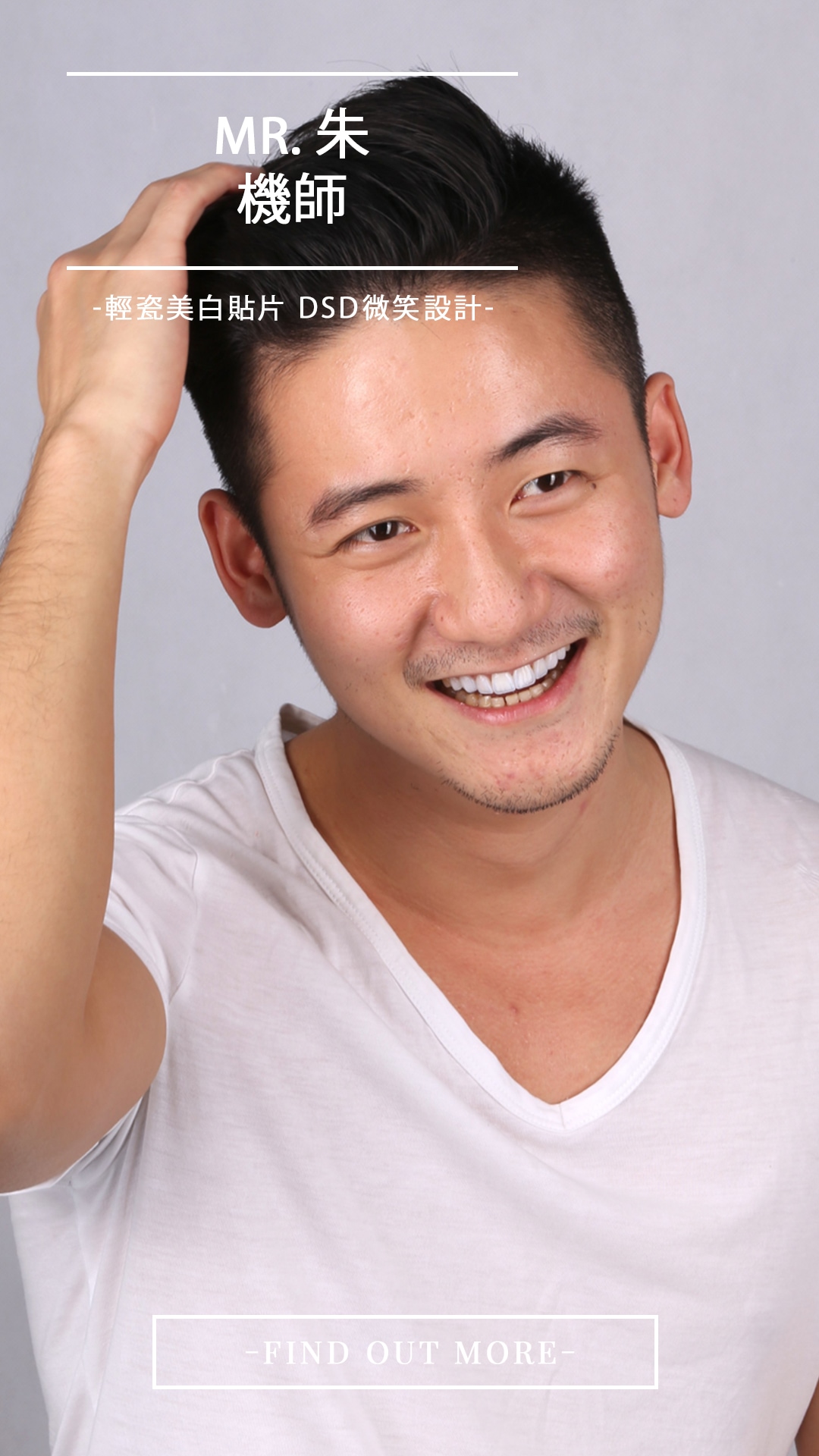Read more about the article 牙齒矯正後用陶瓷貼片美白，一天就讓機師朱先生化身陽光型男
