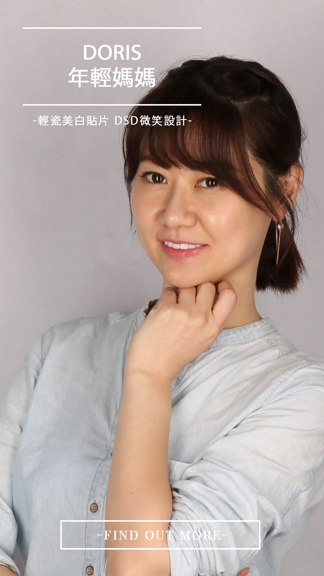 Read more about the article 陶瓷貼片 一次解決Doris牙齒黃 與門牙亂問題! 更快更美又免牙齒矯正!