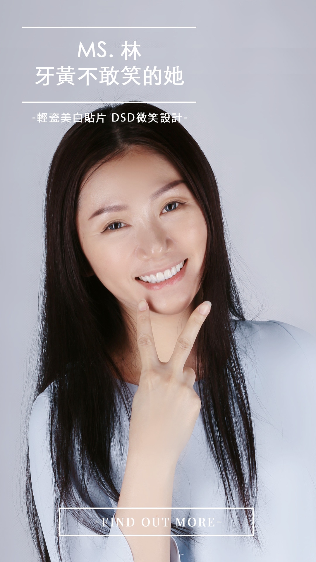 Read more about the article 牙齒黃黃的笑起來好尷尬？陶瓷貼片美白牙齒讓你從此愛上鏡中笑容