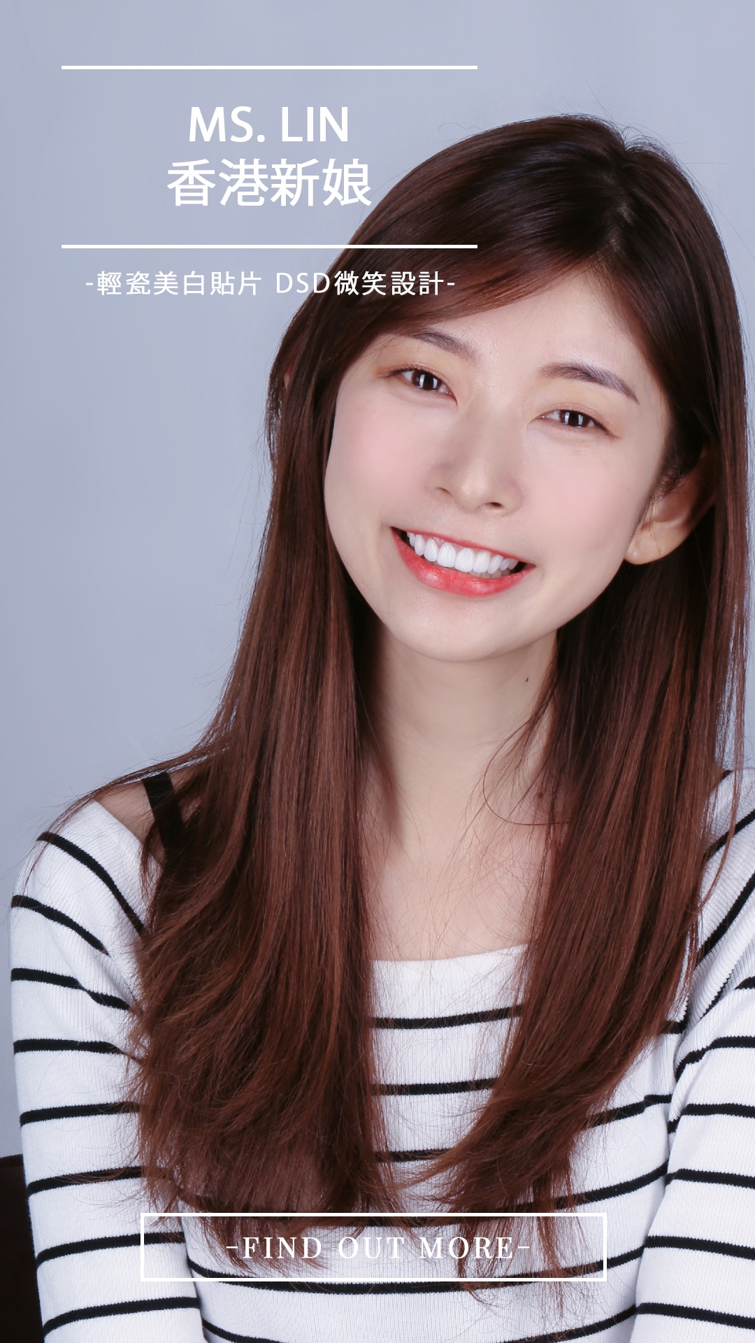 Read more about the article 瓷牙貼片讓她一日成為最美準新娘，香港來台完成渴望笑容