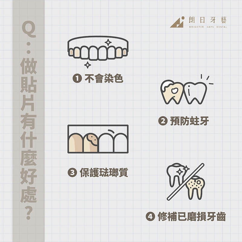 全瓷貼片-陶瓷貼片優點-台中瓷牙貼片-推薦-朗日牙藝