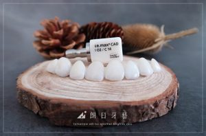 牙齒貼片失敗-陶瓷貼片後悔-瓷牙貼片-副作用-台中陶瓷貼片-朗日牙醫