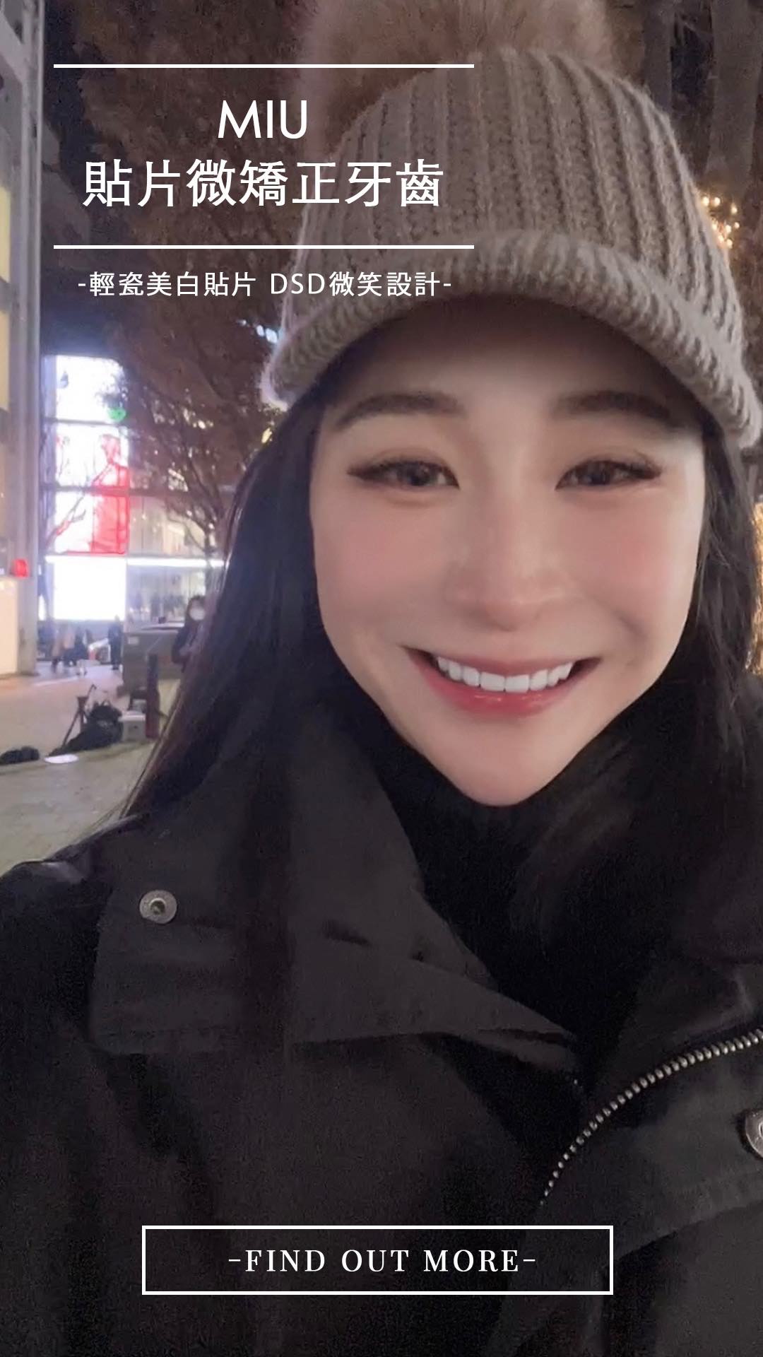 矯正後牙齒跑掉怎麼辦？陶瓷貼片微矯正一日變美
