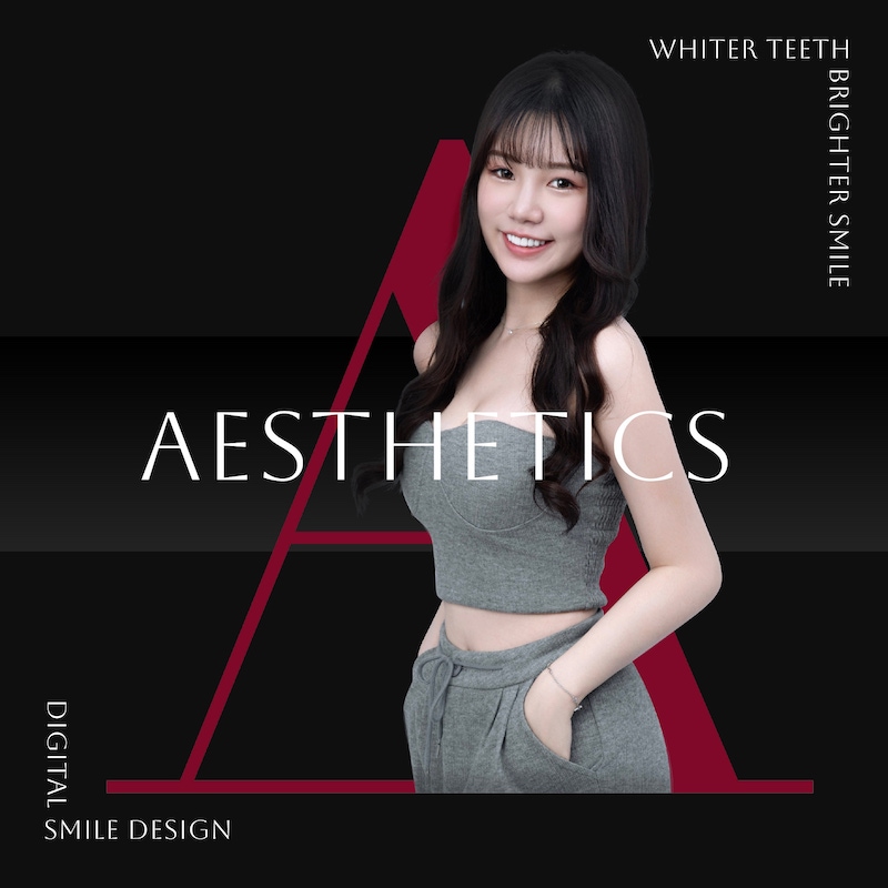 Read more about the article 門牙暴牙用陶瓷貼片/全瓷冠微矯正，美睫師笑容閃耀最美光芒