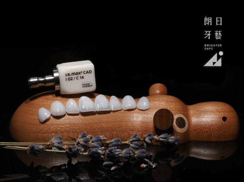 朗日陶瓷貼片材料,使用歐洲知名大廠瓷塊:E.max CAD – Ivoclar Vivadent