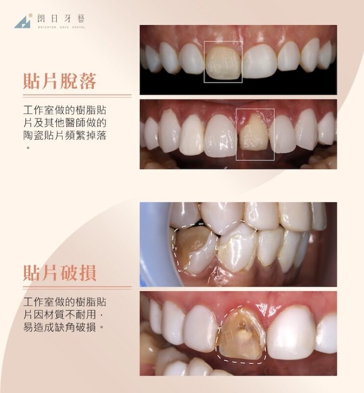 貼片脫落破損示意圖