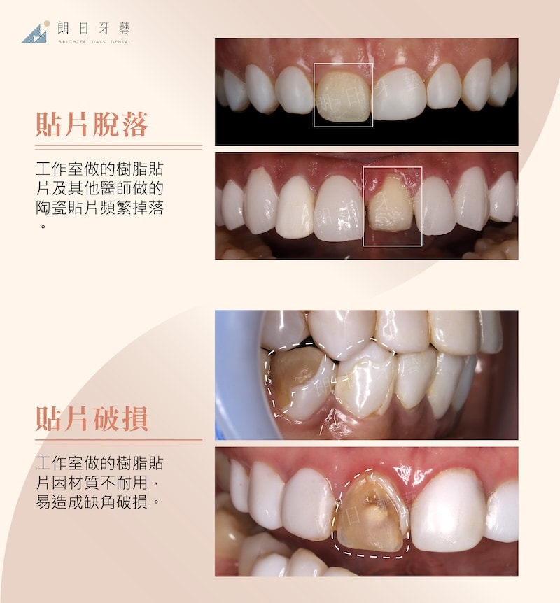 貼片脫落破損示意圖