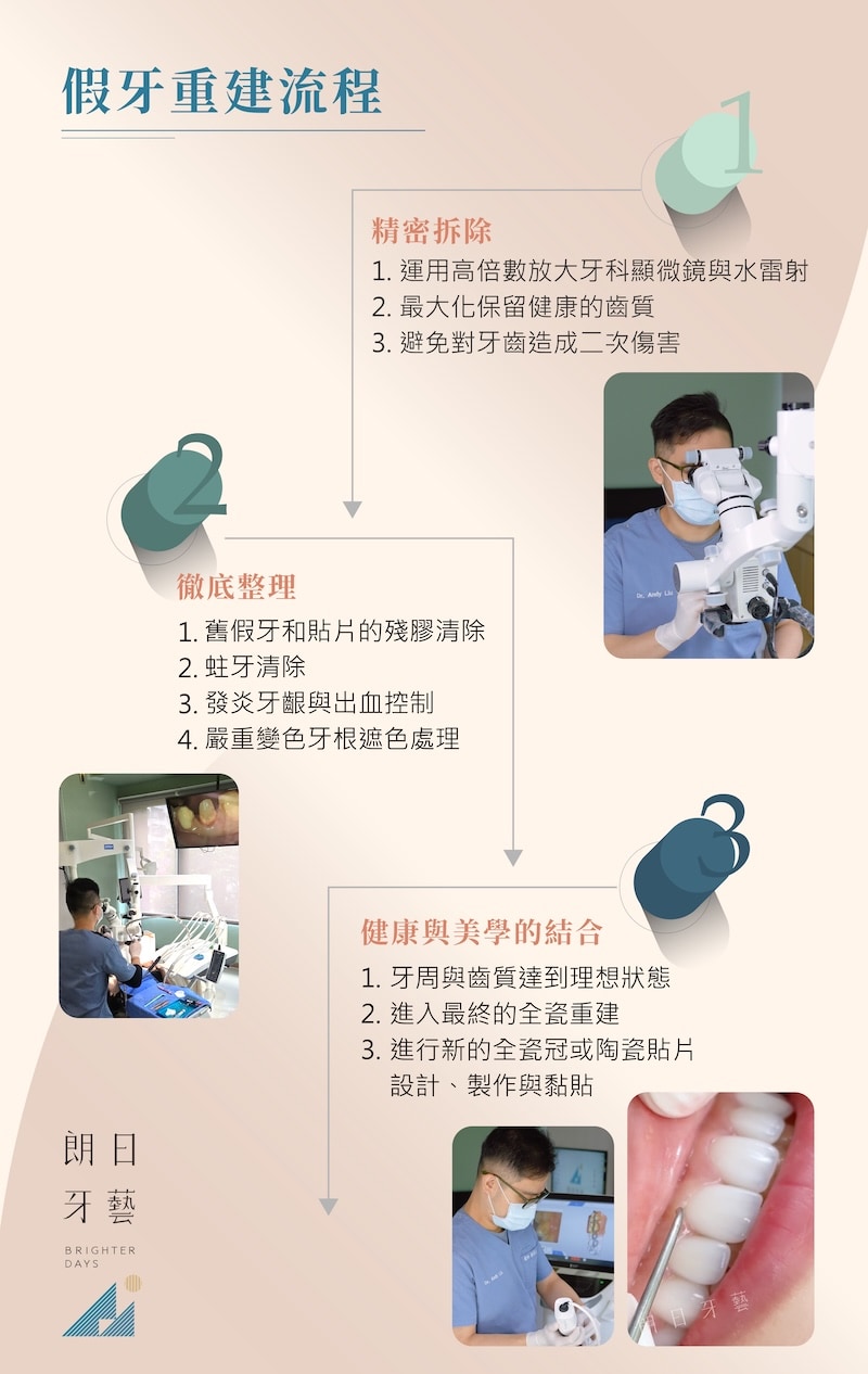 假牙重做流程與精密拆除清創流程示意圖